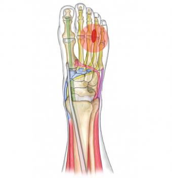 tratamentul inflamației metatarsiene dureri articulare pete roșii pe picior